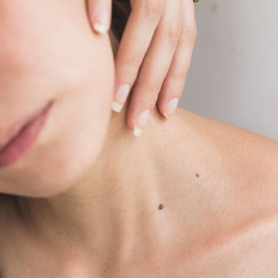 Mole Removal